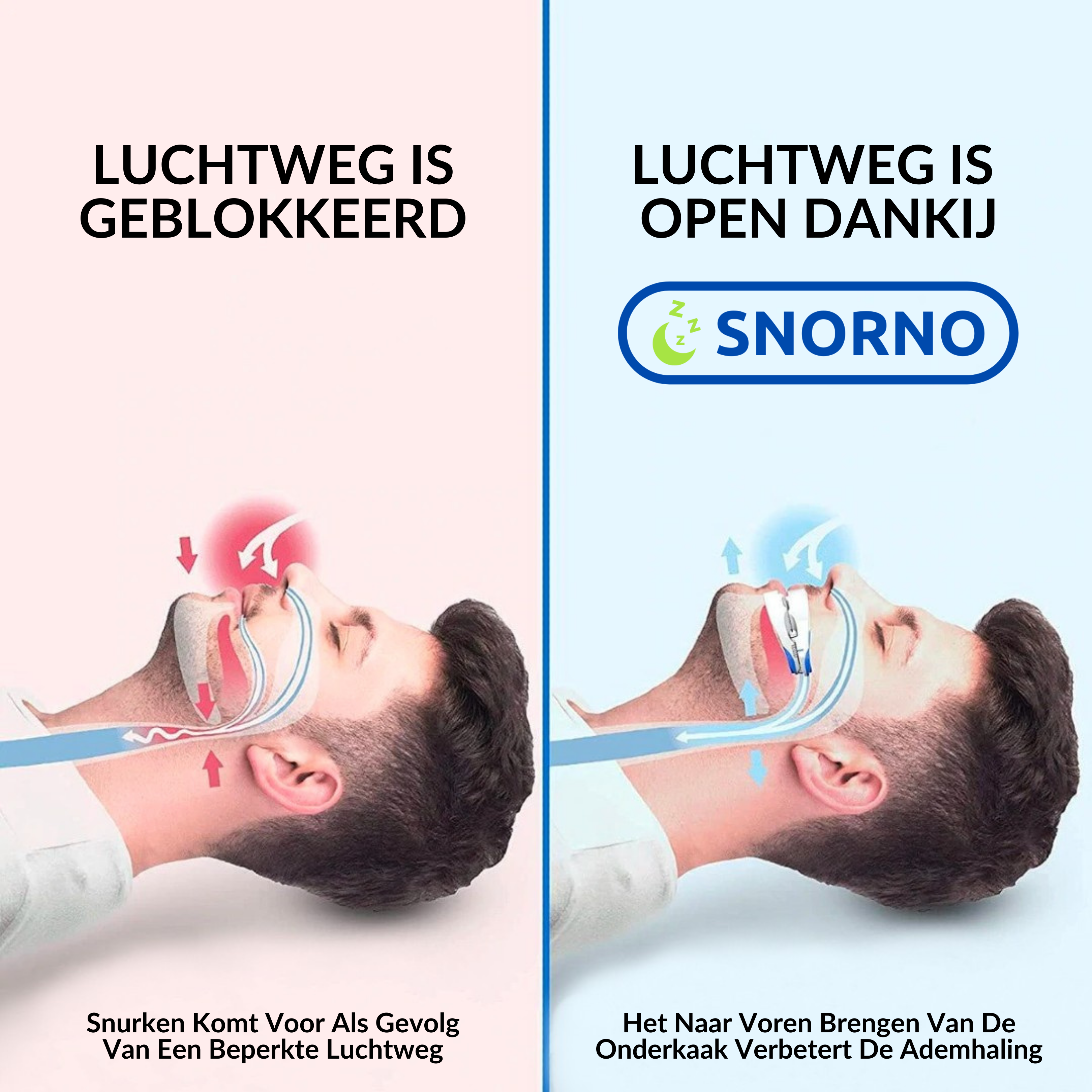 Anti-Snurk Beugel | Gebruiksvriendelijk & premium comfort