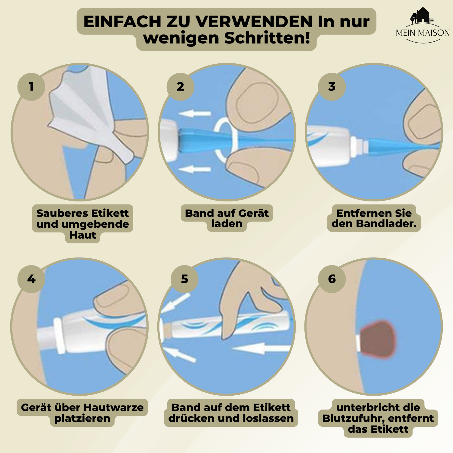 DermaLinx Wrattenverwijderaar | Pijnloze Verwijdering van Wratten & Moedervlekken | Voor Thuis | Zonder Operatie