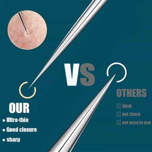 Ariel - Pincet Voor Een Perfecte Huid