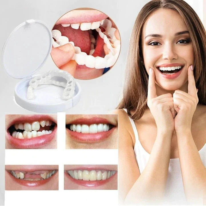 Snap-On Smile Veneers – Herbruikbare Tanden Facings voor een Stralende Glimlach zonder Tandarts